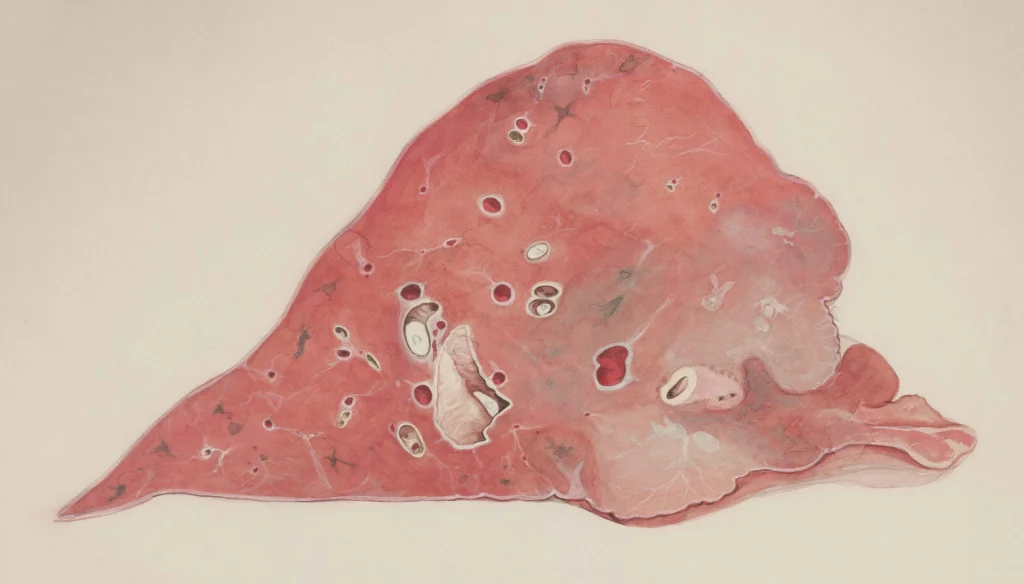 živila in navade, ki na naraven način podpirajo delovanje jeter